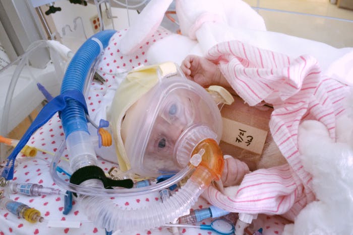 Riley as a baby in the intensive care unit